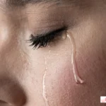 cara mengatasi mata sembab