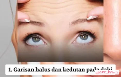 tanda sugar face pada wajah