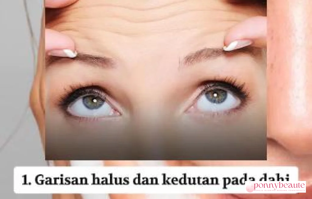 tanda sugar face pada wajah